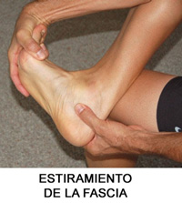 Fascitis plantar